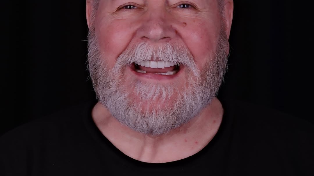 Volker